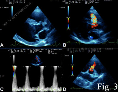 DIFETTO DEL SETTO INTERVENTRICOLARE: CAUSE,SINTOMI,DIAGNOSI E TERAPIA ...